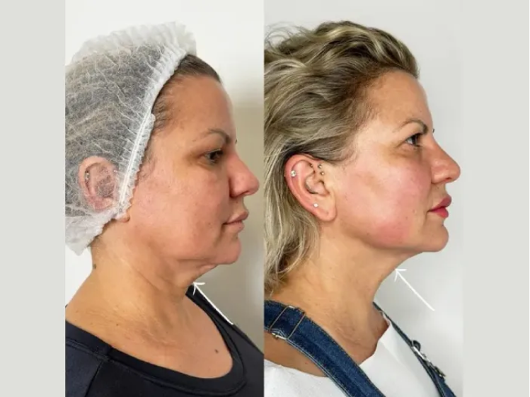 Best Plastic Surgeon in Dubai for Advanced Anti-Aging Solutions